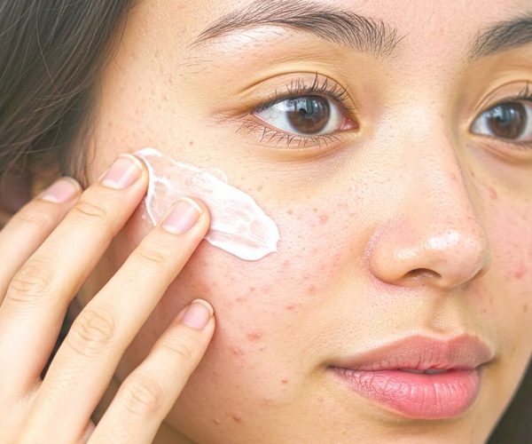 ¿Qué tipos de grano existen y cómo eliminarlos?